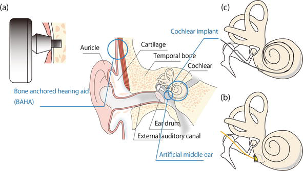 ���l�� ������ ����ԭ���c����
